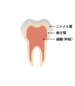 進行 を 止める 虫歯 の